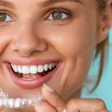 Considering Getting Invisalign®? Here’s Everything You Need to Know